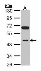 NBP1-31475 - INPP1 / IPPase