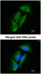 NBP1-31476 - DPP3
