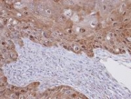 NBP1-31477 - IPP isomerase 1 / IDI1