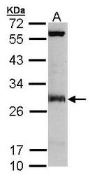 NBP1-31477 - IPP isomerase 1 / IDI1