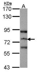 NBP1-31501 - RASGRP3