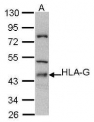 NBP1-31516 - HLA class I alpha G / HLA-G