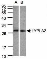 NBP1-31538 - LYPLA2