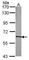 NBP1-31539 - TrkC