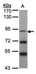 NBP1-31539 - TrkC