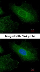NBP1-31553 - Radixin / RDX