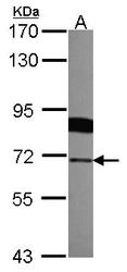 NBP1-31553 - Radixin / RDX