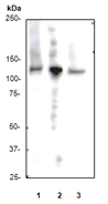NB110-57458 - Retinoblastoma-associated protein / RB1
