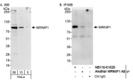 NB110-61626 - ATPase WRNIP1