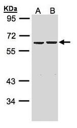NBP1-31566 - ZNF306