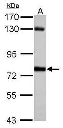 NBP1-31584 - BUB1A