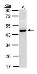 NBP1-31593 - HPD / PPD
