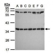NBP1-31598 - RPS3A
