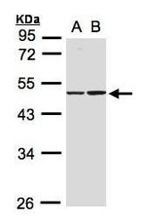 NBP1-31599 - Isocitrate dehydrogenase / IDH