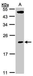 NBP1-31618 - TPRKB