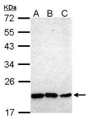 NBP1-31642 - NKX2-8