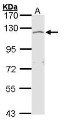 NBP1-31645 - Exostosin-like 3