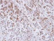 NBP1-31645 - Exostosin-like 3