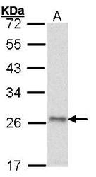 NBP1-31646 - ATP synthase subunit O