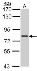 NBP1-31658 - RFX3