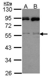 NBP1-31668 - MAPK9 / JNK2