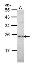 NBP1-31680 - CHP2