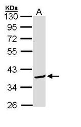 NBP1-31701 - Bcl-2-like 12