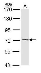 NBP1-31703 - DYNC1I2