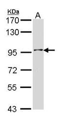 NBP1-31705 - INPP5B / 5PTase 2