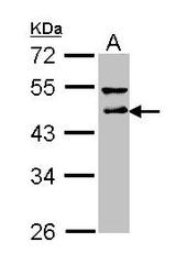 NBP1-31715 - DLST / DLTS