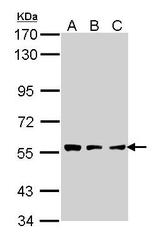 NBP1-31758 - Tripeptidyl-peptidase 1 (TPP1)