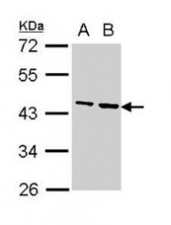 NBP1-31766 - Fibrinogen gamma chain