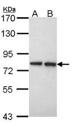 NBP1-31814 - Exostosin-2