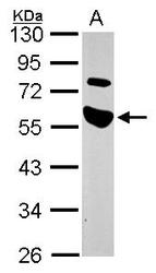NBP1-31854 - TRAIP / RNF206