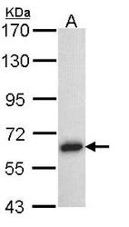 NBP1-31856 - TRAF5 / RNF84