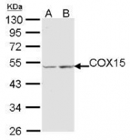 NBP1-32018 - Beta-galactosidase