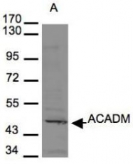 NBP1-32028 - ACADM