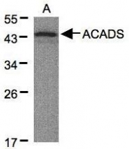 NBP1-32032 - ACADS