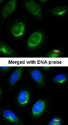 NBP1-32043 - Laminin beta-1 / LAMB1