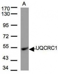 NBP1-32045 - UQCRC1 (Complex III subunit core 1)
