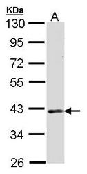 NBP1-32048 - DMC1 / LIM15