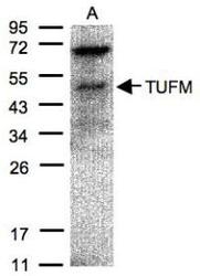 NBP1-32051 - TUFM