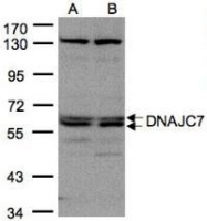 NBP1-32127 - DNAJC7 / TPR2