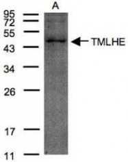 NBP1-32144 - TMLHE / TMLD