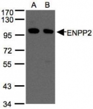 NBP1-32162 - Autotaxin / ENPP2