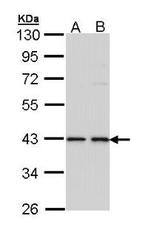 NBP1-32175 - DNAJB6