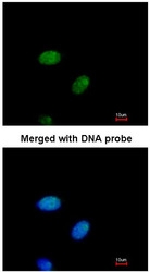 NBP1-32175 - DNAJB6
