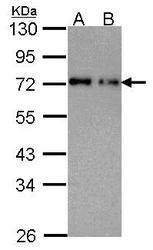 NBP1-32177 - NUP62