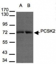 NBP1-32186 - NEC2