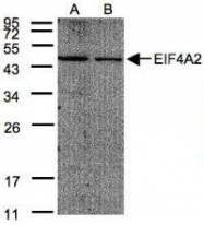 NBP1-32195 - EIF4A2